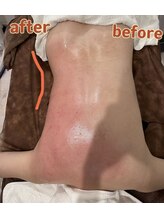 アムール(Amour)/ハイパー7とシェイプ15分の効果