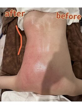 アムール(Amour)/ハイパー7とシェイプ15分の効果