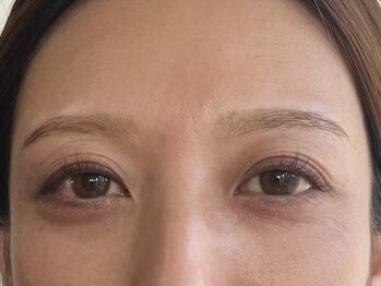 シャーム(scharm)/美まつげ&美眉