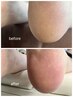 【がさがさかかとにさようなら】足裏角質ケア