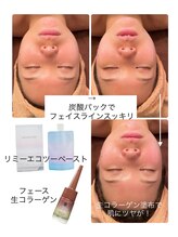 ラ ルミエール(La Lumiere)/肌質に合わせて化粧品をチョイス