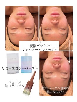ラ ルミエール(La Lumiere)/肌質に合わせて化粧品をチョイス
