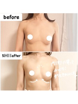 つばききよら/ボリュームUP&ぐっと寄りバスト