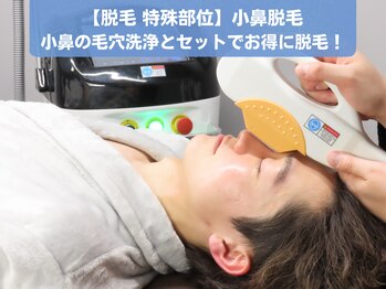 イエス 東京池袋店(YES)/【特殊部位】小鼻脱毛