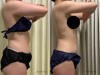 レイル(REIR)/身体の厚みにご注目◎