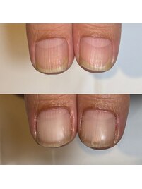 男性のお客様の自爪風ジェル