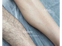 ハリウッドブロウリフト ワクシー 表参道店(HOLLYWOOD BROW LIFT WAXYYY.)/大人気メンズ脱毛