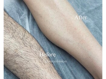 ハリウッドブロウリフト ワクシー 表参道店(HOLLYWOOD BROW LIFT WAXYYY.)/大人気メンズ脱毛