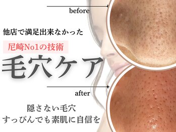 メゾン ド エム(maison de M)/毛穴エクストラクション