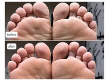 カシェット(Cachette)/60代男性◎足裏角質ケア90分