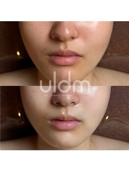 ジュエッテ(jouete)/ウルドム管理