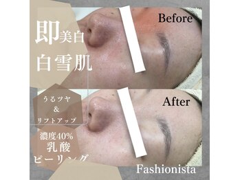 ファッショニスタ 恵比寿(Fashionista)/スノーパールのbefore after