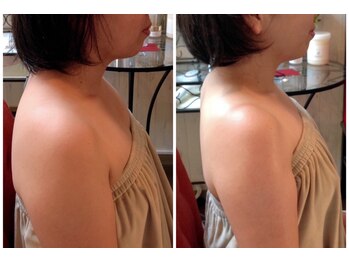 ナロウ(Narow)/モテ肌・小顔＆ハーブピーリング