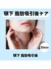 予約数No.３【顎下吸引専用】必要インディバ時間３０分