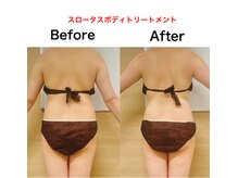 エフクレール(Ef Clair)/スロータス施術ビフォーアフター