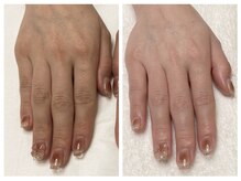 キレイテ 福岡天神店/シワ、むくみのお悩み