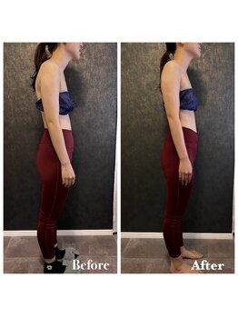 アイリアン(AiLien)/スマホ首も改善