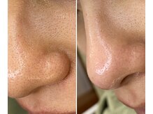 サイ(Sai)/before⇒after