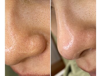 サイ(Sai)/before⇒after