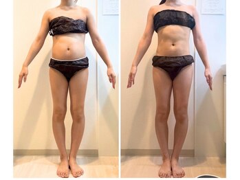 ヨサパーク フェリニタ(YOSA PARK felinita)/短期集中痩せ