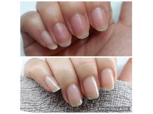 スノー(SNOW)の雰囲気（爪質改善＆自爪育成。深爪/割れ爪/小さい爪に悩まれている方に。）