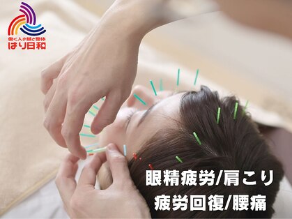 はり日和の写真