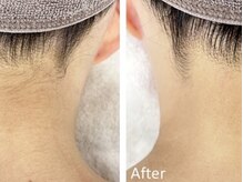 エースビューティー(Ace.Beauty)/