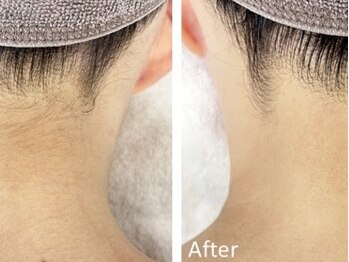 エースビューティー(Ace.Beauty)/