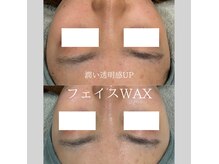 ラナ ビューティー(LANA beauty)の雰囲気（潤い透明感UP☆ANNONWAX）