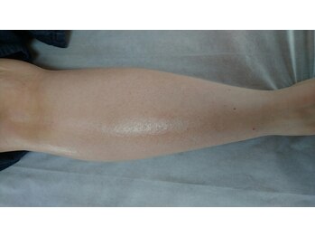 ブラジリアンワックスサロンカリーナ(Carina)/ひざ下のワックス脱毛