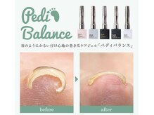 ファイブシー(5c)の雰囲気（＊巻き爪メニュー＊韓国特許取得のペディバランスで巻き爪ケア＊）