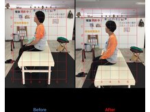 ストレチックス 近江八幡店/BeforeAfter