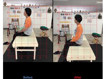 ストレチックス 近江八幡店/BeforeAfter