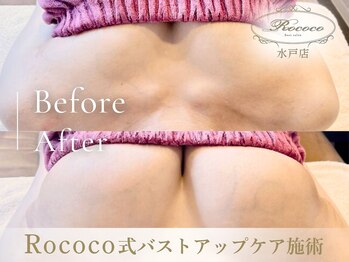 ロココ 水戸店(Rococo)/BEFORE/AFTER