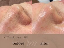 ヴィーヴォ(Vivo)/マツヤニ＆クレイ