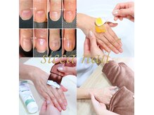 シッカネイル(sicca nail)