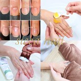 シッカネイル(sicca nail)