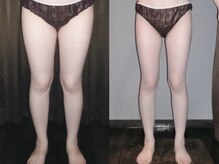 アルメリア(Armeria)/【結果写真　オーダーメイド】