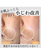 ルアナ(Luana)/【毛穴プロコース 約80分】