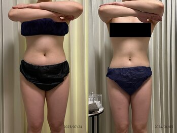 レイル(REIR)/痩身コース90分全身♪