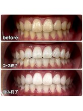 ティースペース 蒲郡店(T-space)/極み