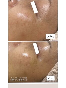 エムイーボーテ(me.Beaute)/【ゾンビマスク】一度でこの効果