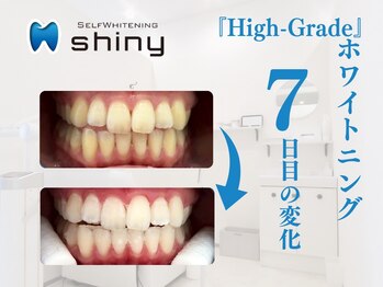 ホワイトニングサロン シャイニー 浜松細島店(shiny)/【超絶・美・白】ホワイトニング