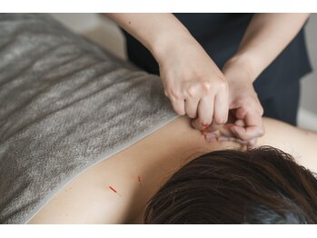 AILE はりきゅうマッサージサロン/ 施術様子【3】鹿児島