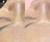 トリンテ バイ フェース(TRINTE by FAITH)