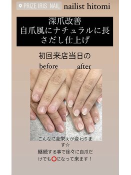 プライズアイリス アイラッシュ 池袋東口店(prize Iris eyelash)/深爪改善【池袋】