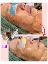 リーシャ(Reesha)/Lit の効果☆