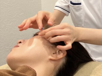 なつめ鍼灸ボディケアサロン/~美容鍼~