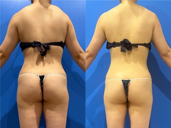 プリオール 高崎店(Prior)/インド痩身