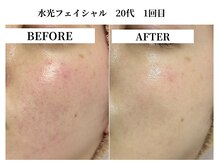 サンビ(SANBI)の雰囲気（6月でも乾燥を感じごわつく肌に！翌日の化粧ノリが抜群に改善◎）
